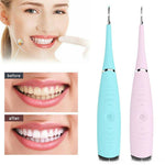 Removedor de Cálculo de Dente Elétrico Ultrassônico Sônico Removedor de Cálculo de Dente Ferramenta de Tártaro para Manchas de Dente Limpador de Dentes para Branquear de Tártaro - Blackstar Liga